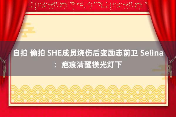 自拍 偷拍 SHE成员烧伤后变励志前卫 Selina：疤痕清醒镁光灯下